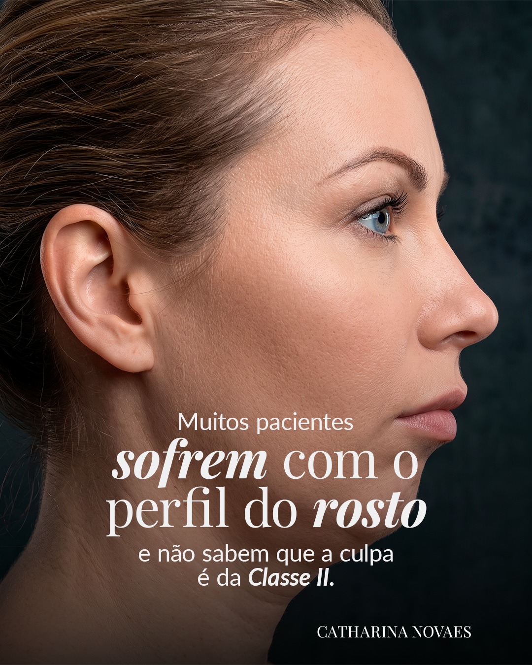 Análisis facial en ortodoncia: más allá de los dientes
