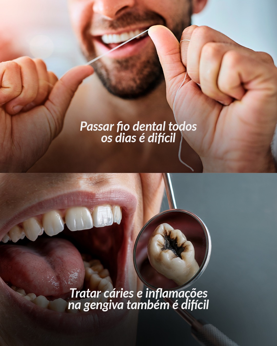 Paciente sorrindo após manter disciplina no tratamento ortodôntico