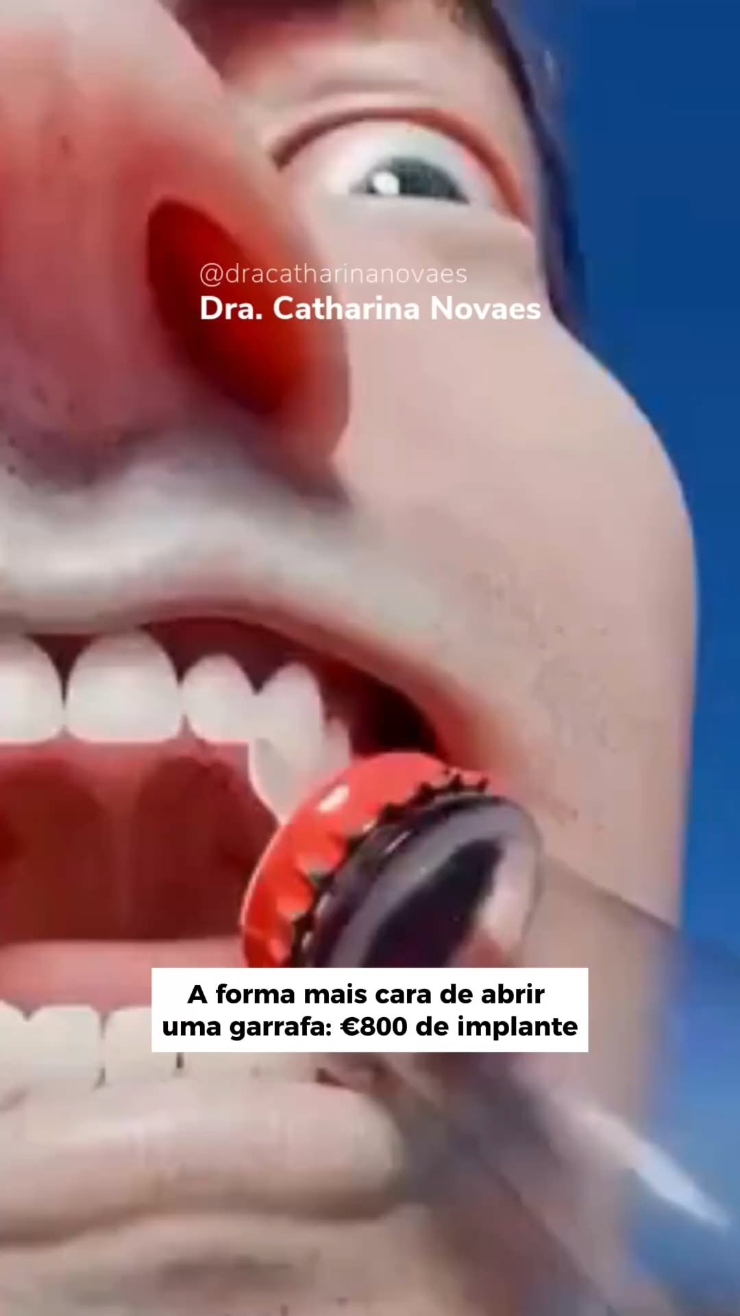 Ouvrir une bouteille avec les dents : risques