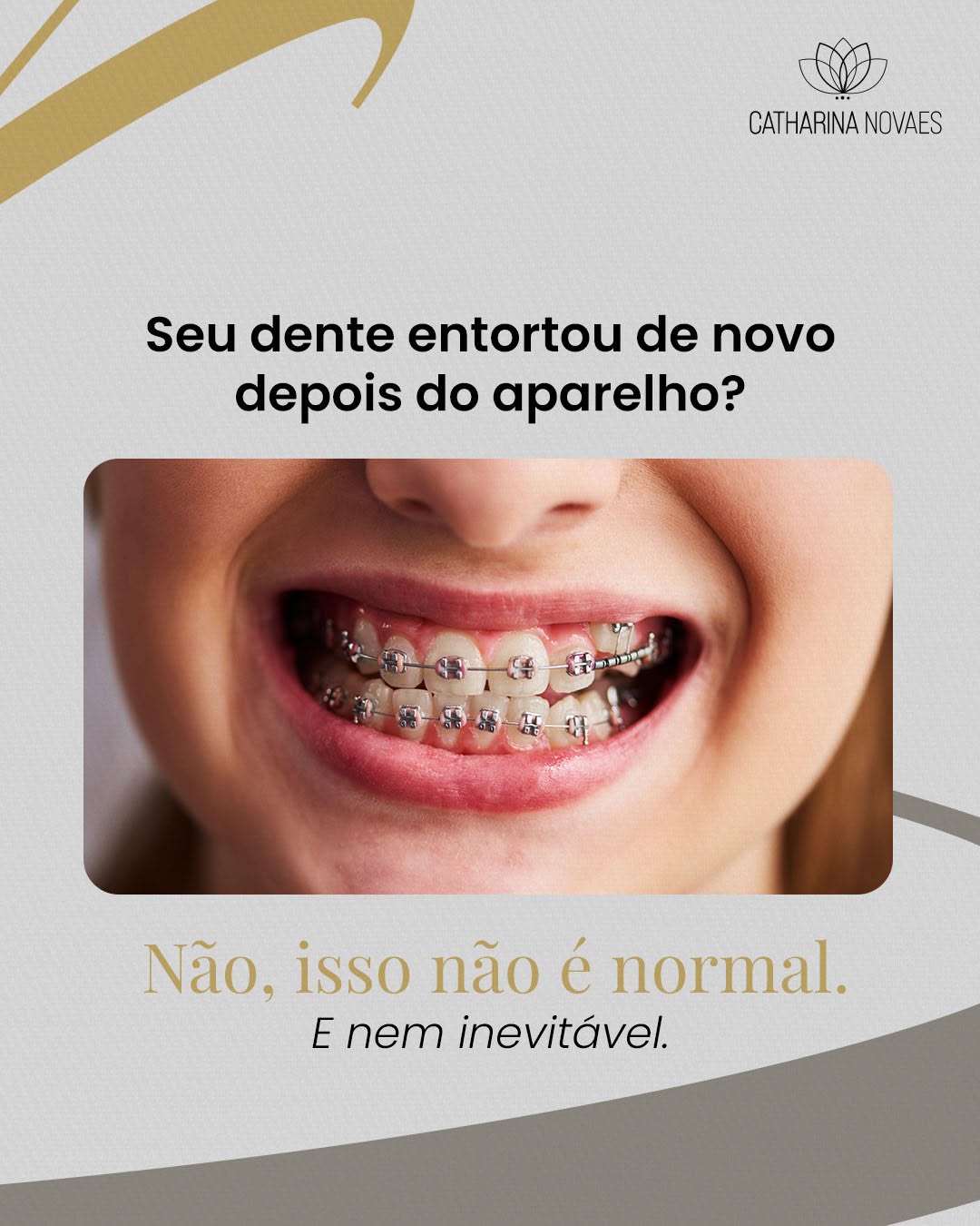 Preventing orthodontic relapse: practical guide in Porto