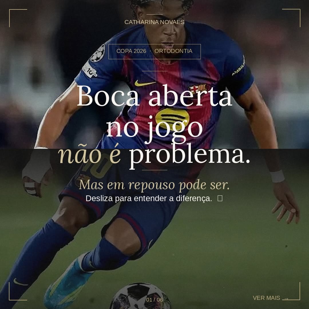 Criança dormindo de boca aberta ilustrando a respiração bucal em crianças e seus efeitos no desenvolvimento facial