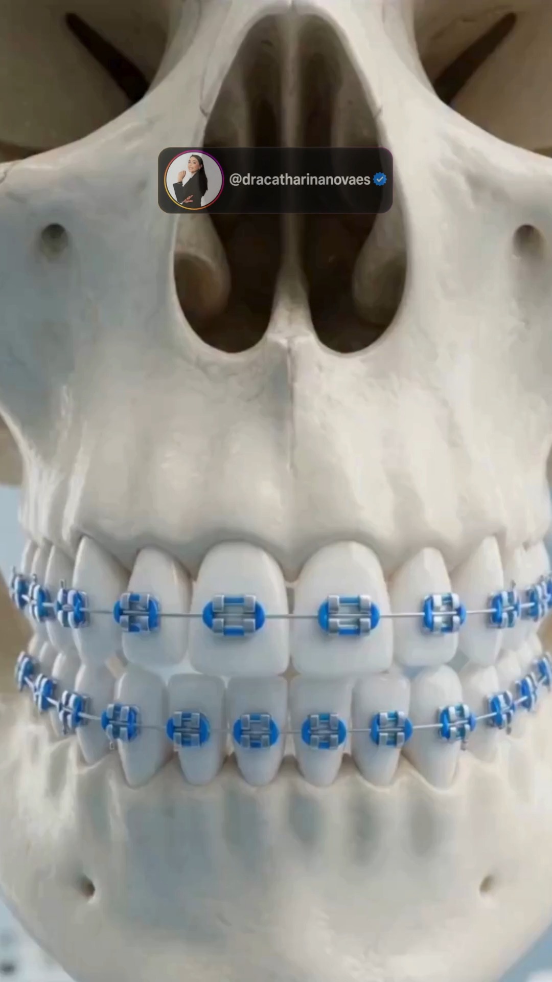 Paciente sorrindo feliz após transformação completa do sorriso em consulta odontológica