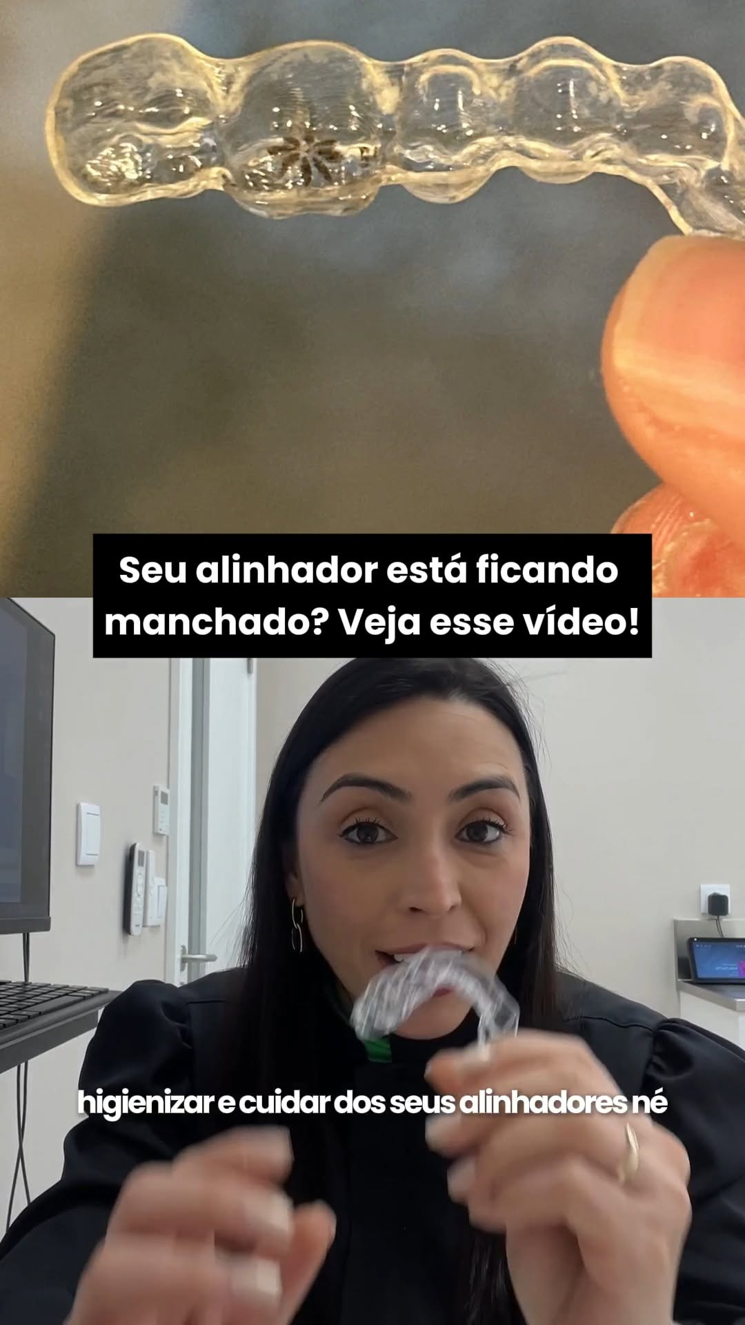 Uso del alineador transparente dentro de la rutina diaria en Oporto