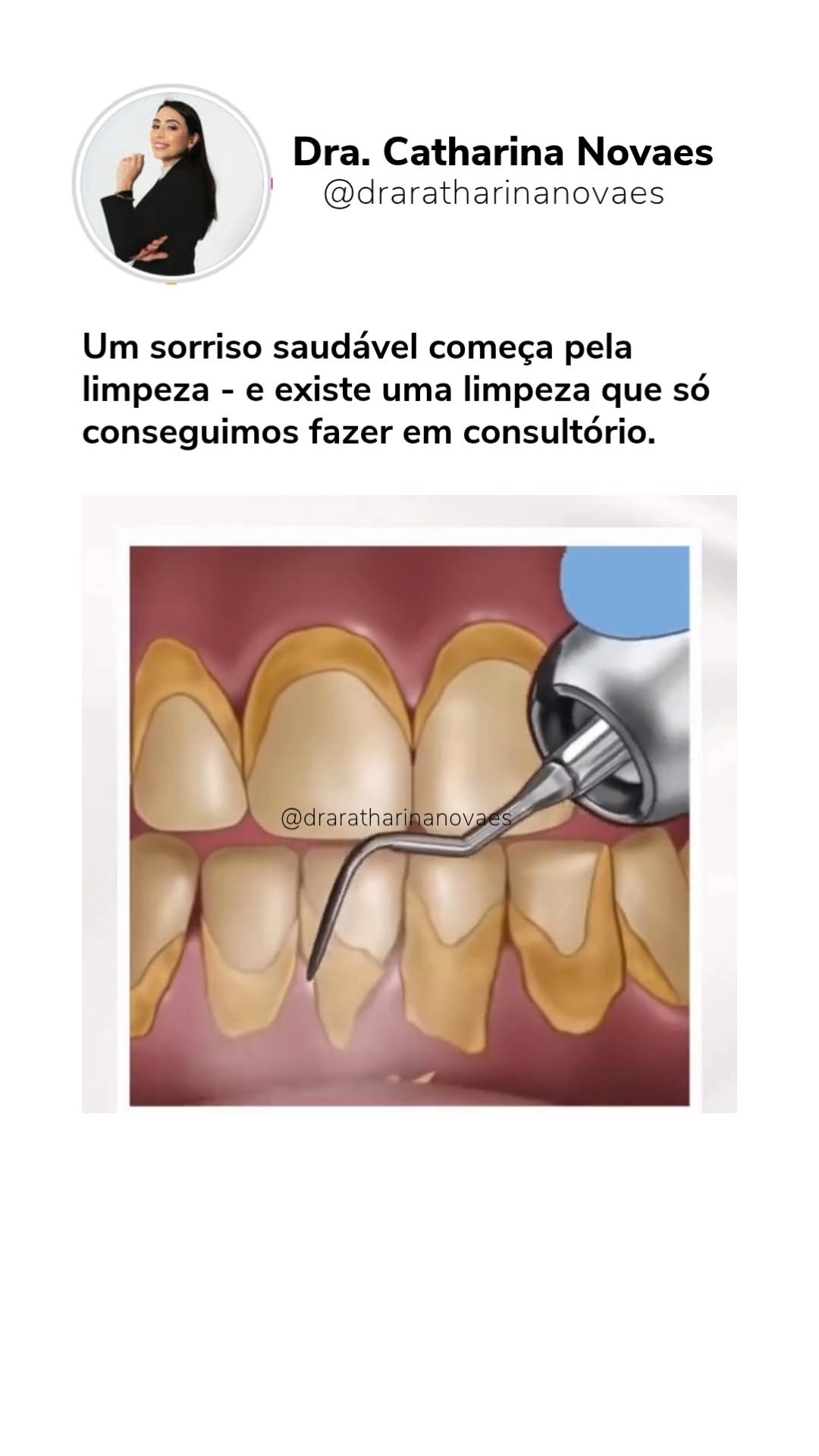 Limpeza dentária profissional: por que fazer sem dor